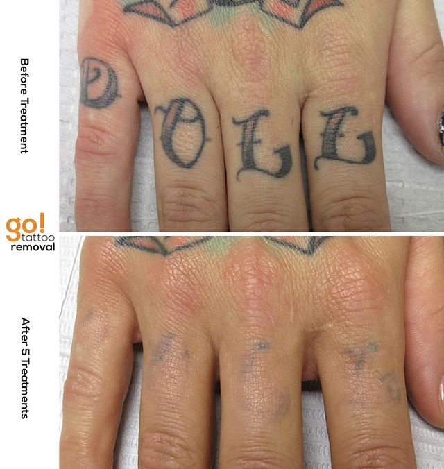 Tattoo Gallery 19 trending finger tattoos before and after fading